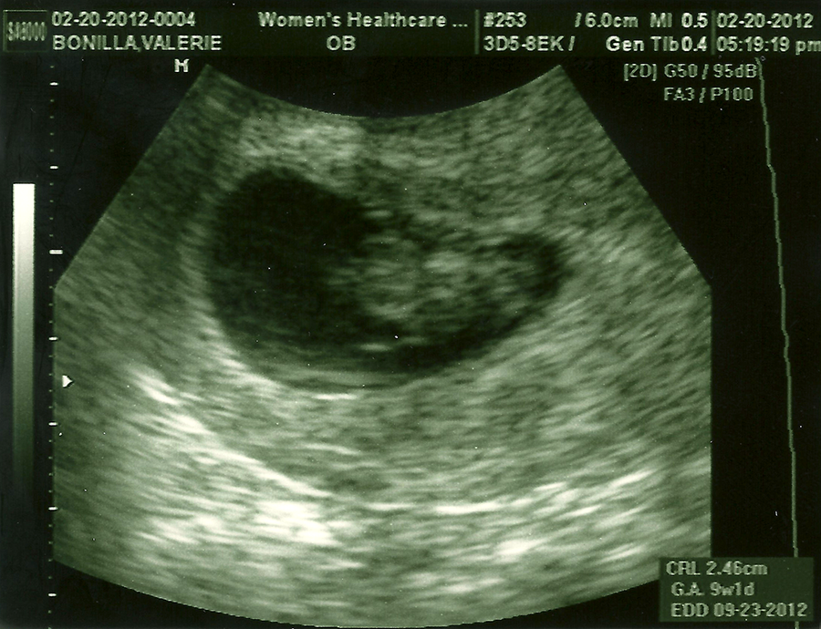 baby-a