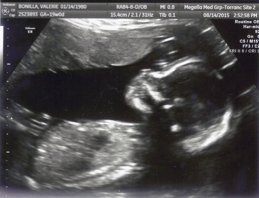 baby-bean-19wks-1