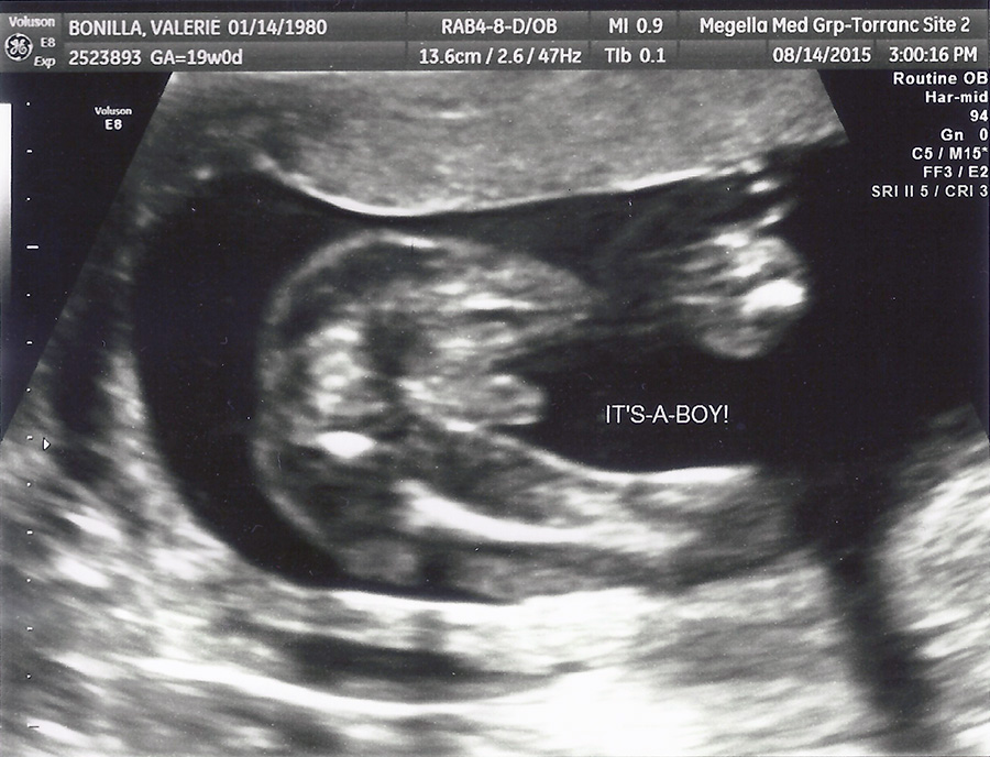 baby-bean-19wks-2